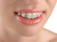 orthodontic dentists in adelaide North Adelaide Orthodontics