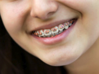 orthodontic dentists in adelaide North Adelaide Orthodontics