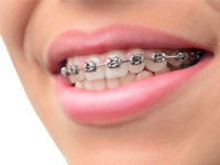 orthodontic dentists in adelaide North Adelaide Orthodontics